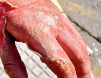 Incendio de una sartén con aceite en Tomares: La importancia de conocer cómo actuar ante un fuego en la cocina