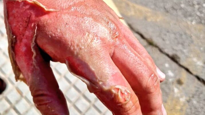 Incendio de una sartén con aceite en Tomares: La importancia de conocer cómo actuar ante un fuego en la cocina